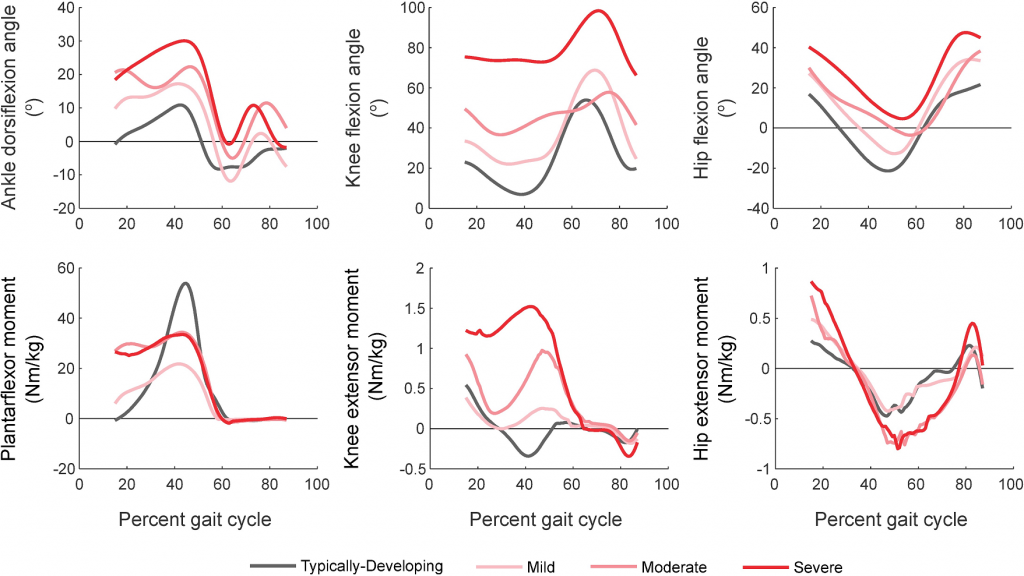 Top: Ankle, knee and hip kinematics for gait in TD children and children with crouch gait. TD children walked with less ankle dorsiflexion and knee flexion during stance than those with crouch gait. Bottom: Ankle, knee and hip moments for gait in TD children and crouch gait. TD children generated larger peak plantarflexor moments and smaller peak knee extensor moments compared to crouch gait. Knee extensor moments increased with increasing crouch severity.