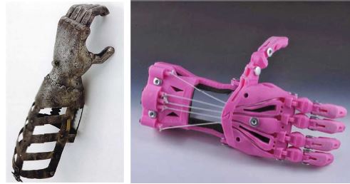 Prostheses from the 15th century (medieval metal hand) to the 21st century (3D-printed enable hand).