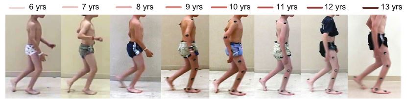 Sagittal-plane images of child from 6-13 years of age.