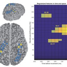 J Wu, BR Shuman, BW Brunton, KM Steele, JD Olson, RPN Rao (2016) “Multistep model for predicting upper-limb 3D isometric force application from pre-movement electrocorticographic features.” IEEE Engineering Medicine & Biology