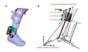 Method combining ultrasound and musculoskeletal modeling to evaluate changes in muscle and tendon length.