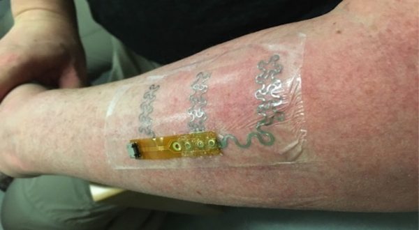 The flexible electrode on the forearm of one of our co-designers.