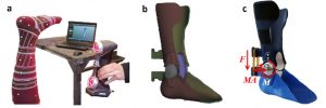 Process used for scanning the foot for the 3D-printed AFO