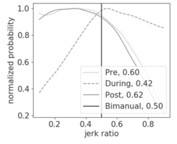A plot of jerk ratio shows the probability distribution from one child with cerebral palsy before, during, and after constraint induced movement therapy. Before therapy, the probability distribution is shifted to the left of the center line, indicating that the individual relies much more on their non-paretic hand during daily life. During therapy, when their non-paretic hand is in a cast, the curve shifts to the right of the center line. This indicates they are using their paretic hand much more - which makes sense, since the other hand is in a cast. Unfortunately, after the cast is removed at the end of therapy, the curve is nearly identical to the curve before treatment, suggesting that after this intensive therapy the child did not use their paretic hand more during daily life.