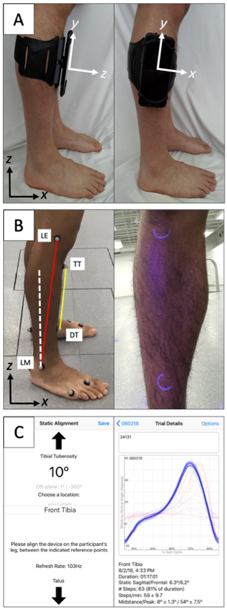 Example of how the smartphone app was used for this research. The top images show a black smartphone attached with a running arm band to the side or front of the shank - the two positions tested in this research. The middle figure shows the placement of the reflective markers for 3D motion analysis to evaluate the accuracy of the smartphone measurements. Markers were placed on the lateral epicondyle of the knee, lateral maleolus of the ankle, tibial tuberosity, and the distal tibia. Blacklight was used to mark the position of each marker and hide the position from the clinicians. The bottom panel shows screenshots from the app. The first screen is used to align the device and has arrows at the top and bottom that remind the clinician which anatomical landmarks should be used to align the device while displaying the shank-to-vertical angle in real time. The second screenshot shows an example of the calculated shank-to-vertical angle while someone was walking. The average is shown with a bold black line, with all other trials shown in blue and excluded trials (e.g., when someone was stopping or turning) that deviated more than one standard deviation from other trials are shown in red. There is also text below the graph that provides summary measures, like shank-to-vertical angle in mid stand and cadence (steps/min). The results can be exported as a picture or sent via e-mail using the app.